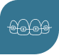 Illustration of teeth with braces on a blue background.