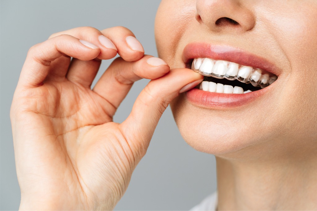 smiling woman with clear retainer