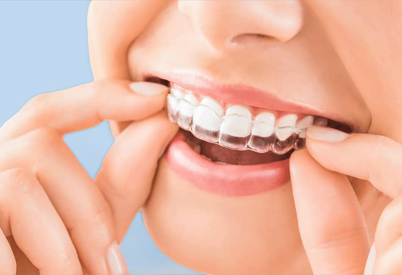 smiling woman wearing Invisalign