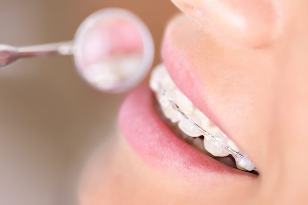 woman with braces