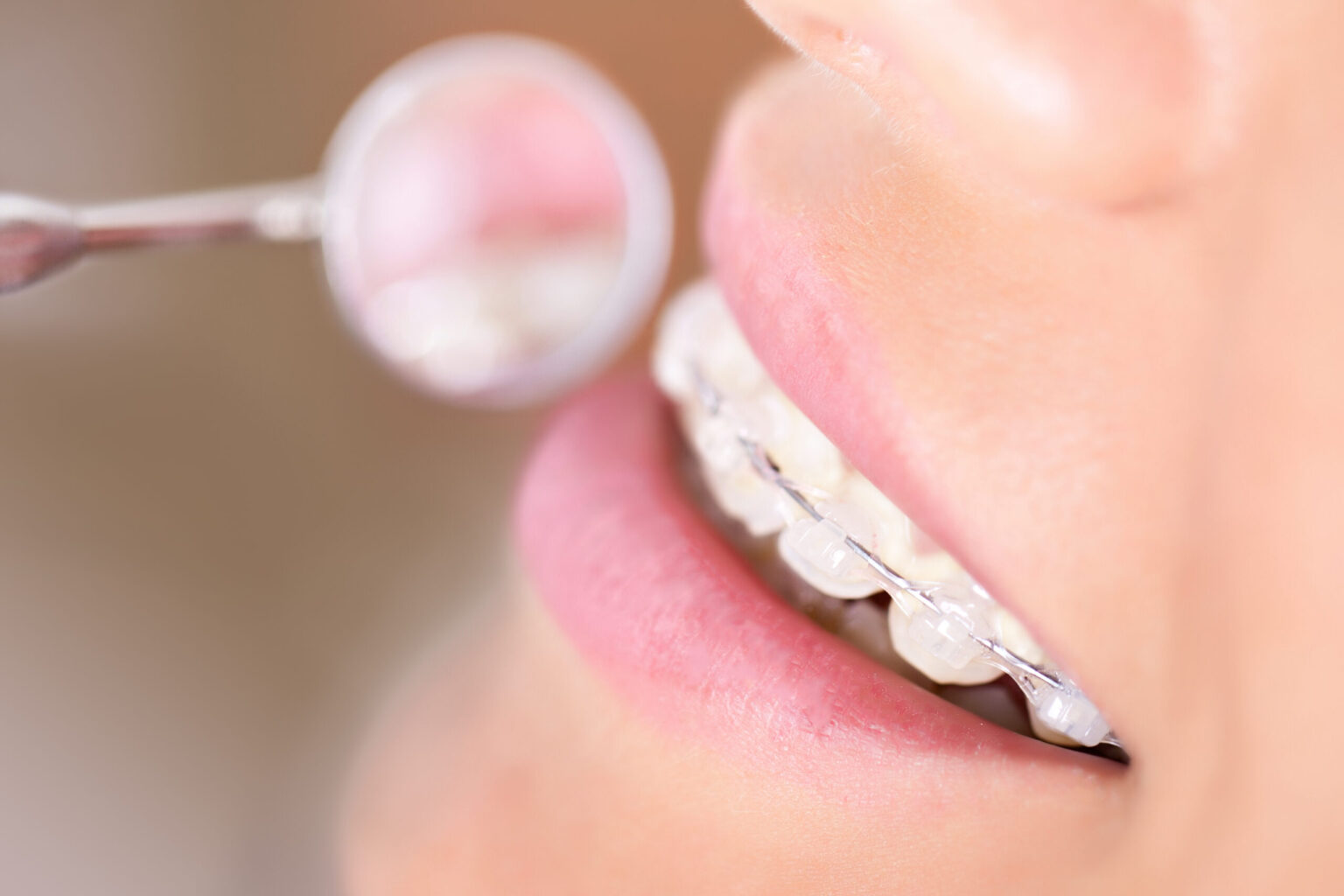 woman with braces
